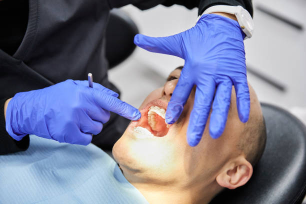 Best Emergency Dental Care for Trauma or Injury in Silver Lake, FL